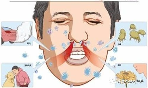 什么是过敏源？过敏源有哪几种？